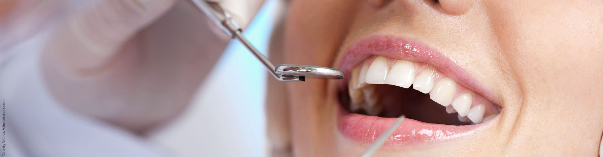 Erhaltung des Zahnstandes nach kieferorthopädischer Behandlung