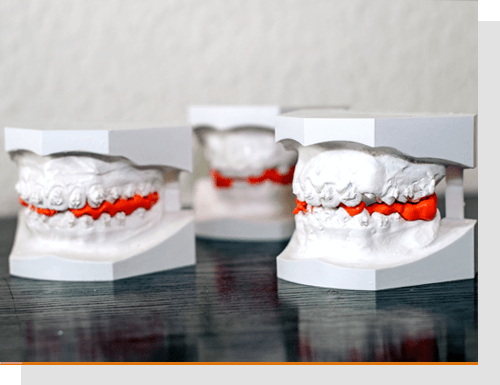 Modellanalyse, Funktionsanalyse der Zähne