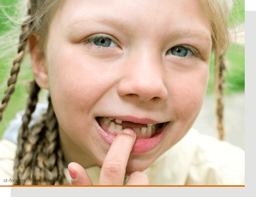 Zahnlücken bei Kindern ausgleichen