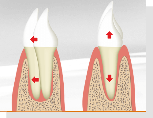 Zahnbewegungen